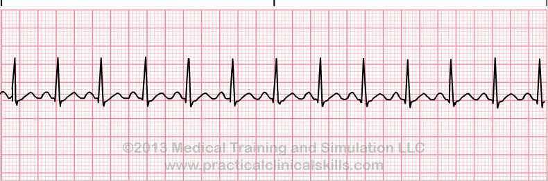 Basic ECG Jeopardy! Jeopardy Template