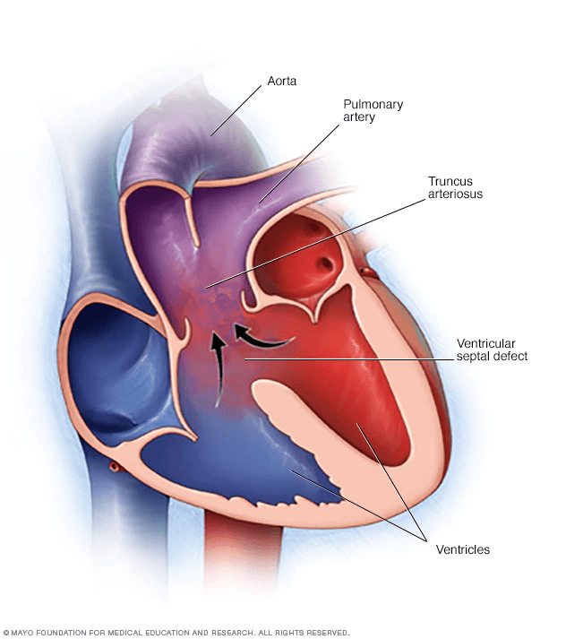 Neonatal Cardiology Jeopardy! Jeopardy Template