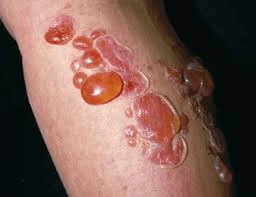 Skin Conditions Jeopardy
