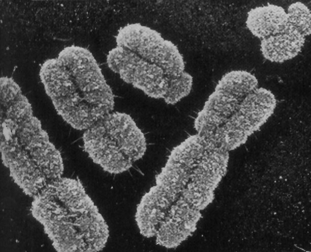 Спаривание хромосом. Хромосома электронная микрофотография. Хромосомы под микроскопом. Хромосомы в микроскопе. Хромосомы человека под микроскопом.
