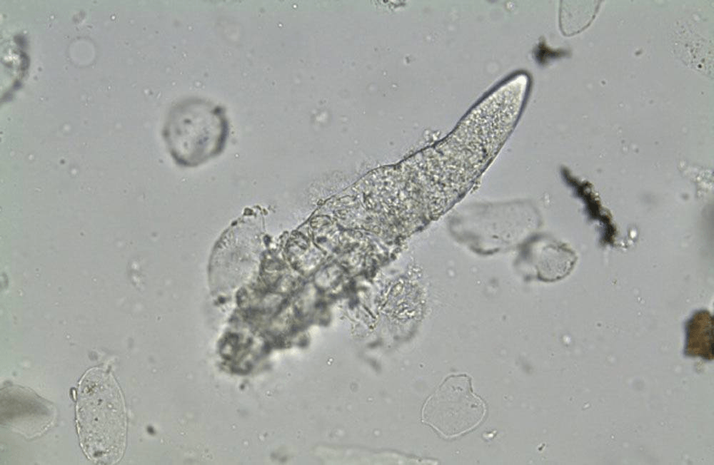 Demodex. Демодекоз микроскопия. Демодекоз микроскопия у человека.