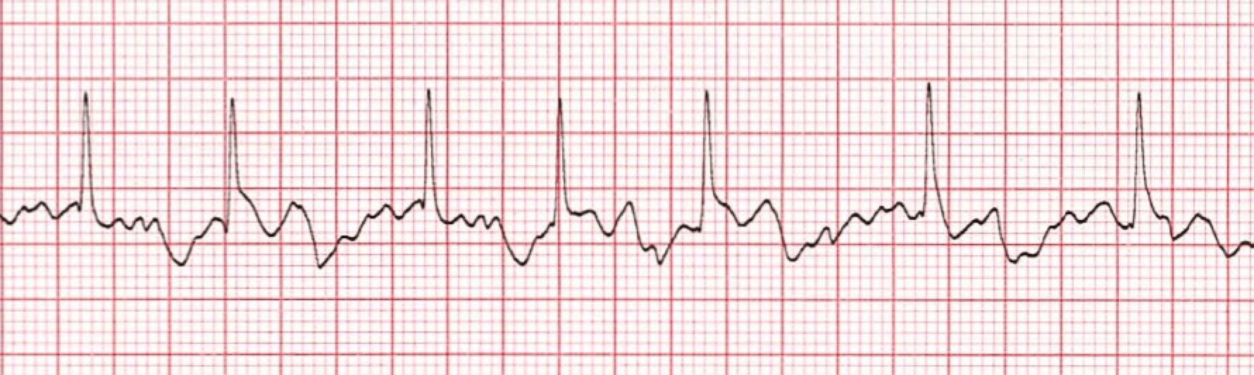 Basic ECG Jeopardy Template