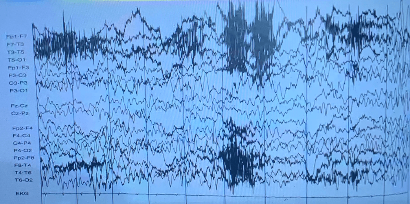 Filters in the Electroencephalogram Jeopardy Template