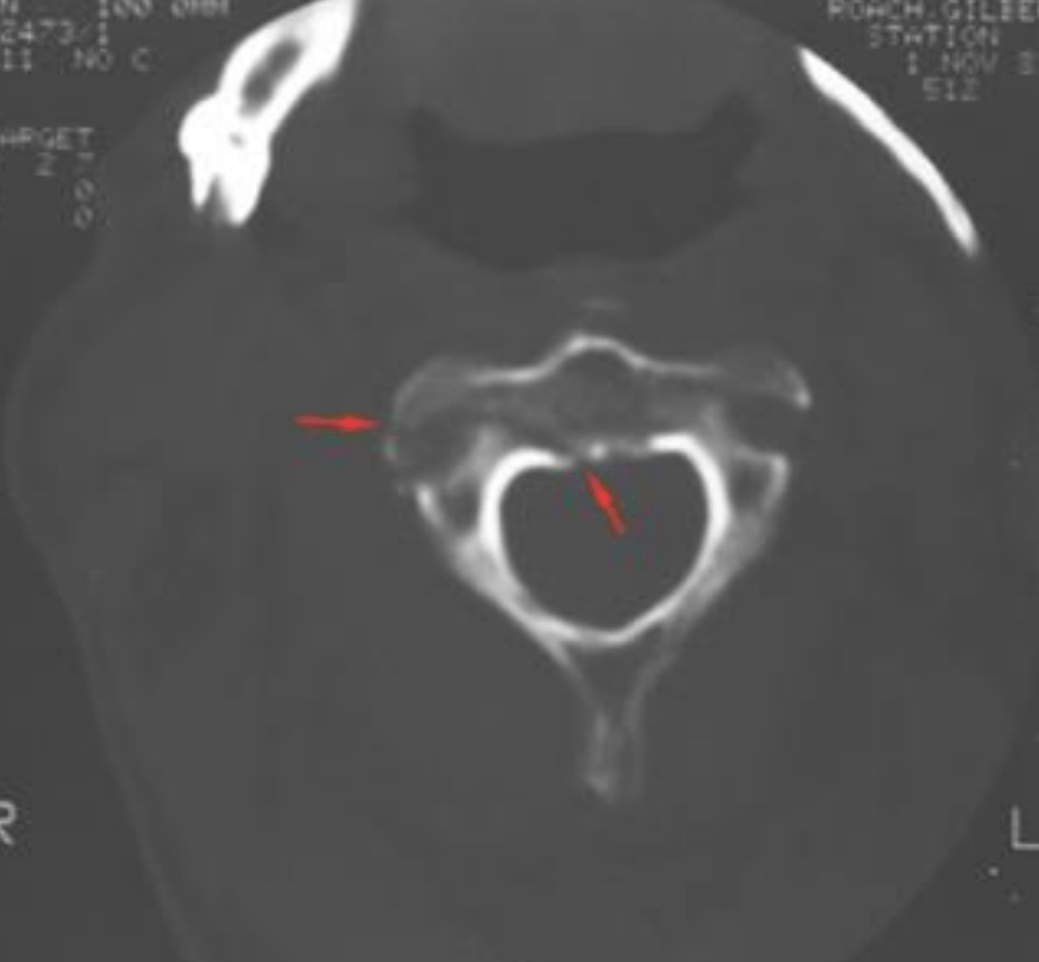 Radiology CSpine & T spine Jeopardy Template