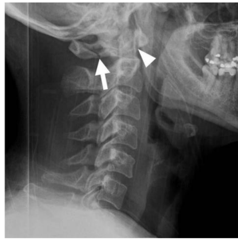Radiology CSpine & T spine Jeopardy Template
