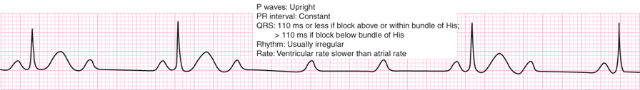 Cardiology Jeopardy Jeopardy Template