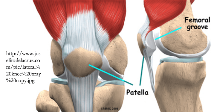 Мышцы коленной чашечки. Patella alta коленного сустава. Медиальный вывих надколенника. Надколенник Patella. Подвывих надколенника коленного сустава.