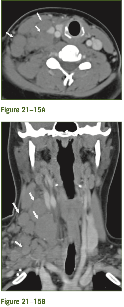 Radiology Jeopardy Jeopardy Template