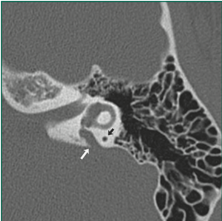 Radiology Jeopardy Jeopardy Template