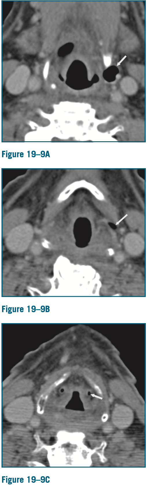 Radiology Jeopardy Jeopardy Template