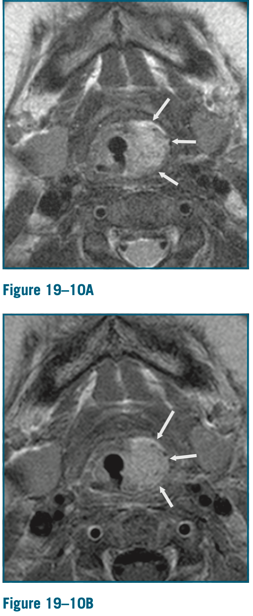 Radiology Jeopardy Jeopardy Template vrogue.co