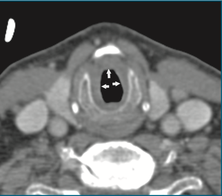 Radiology Jeopardy Jeopardy Template