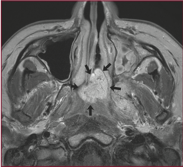 Radiology Jeopardy Jeopardy Template