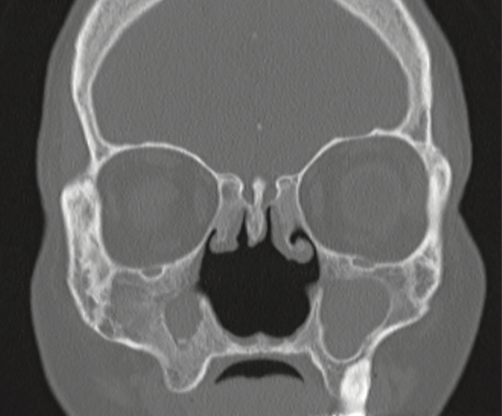 Radiology Jeopardy Jeopardy Template
