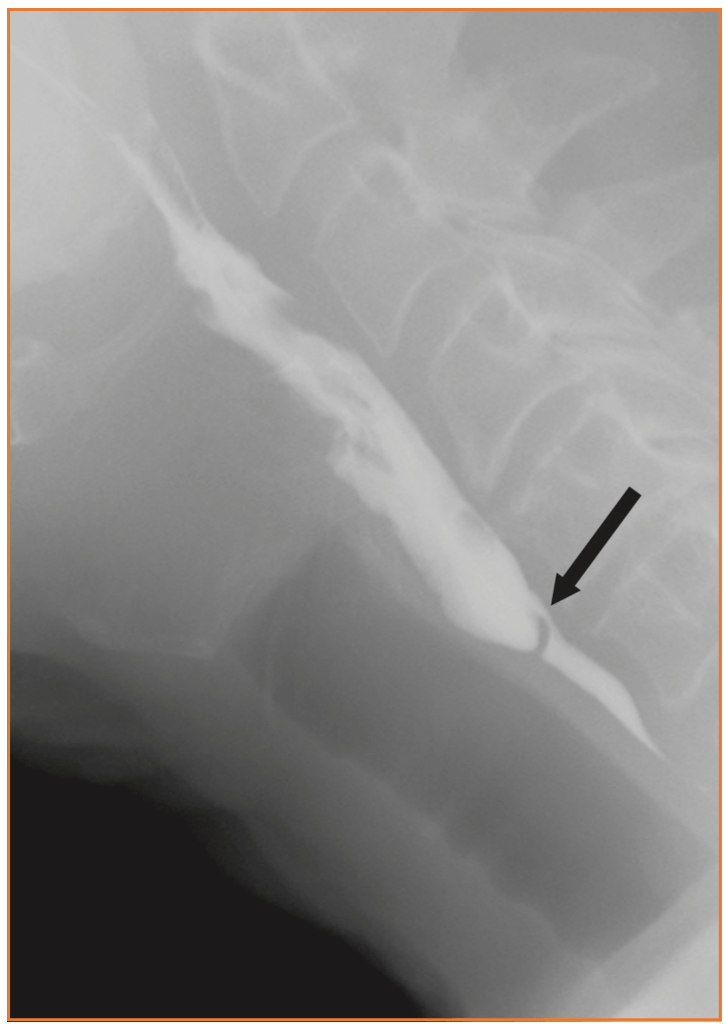 Radiology Jeopardy Jeopardy Template