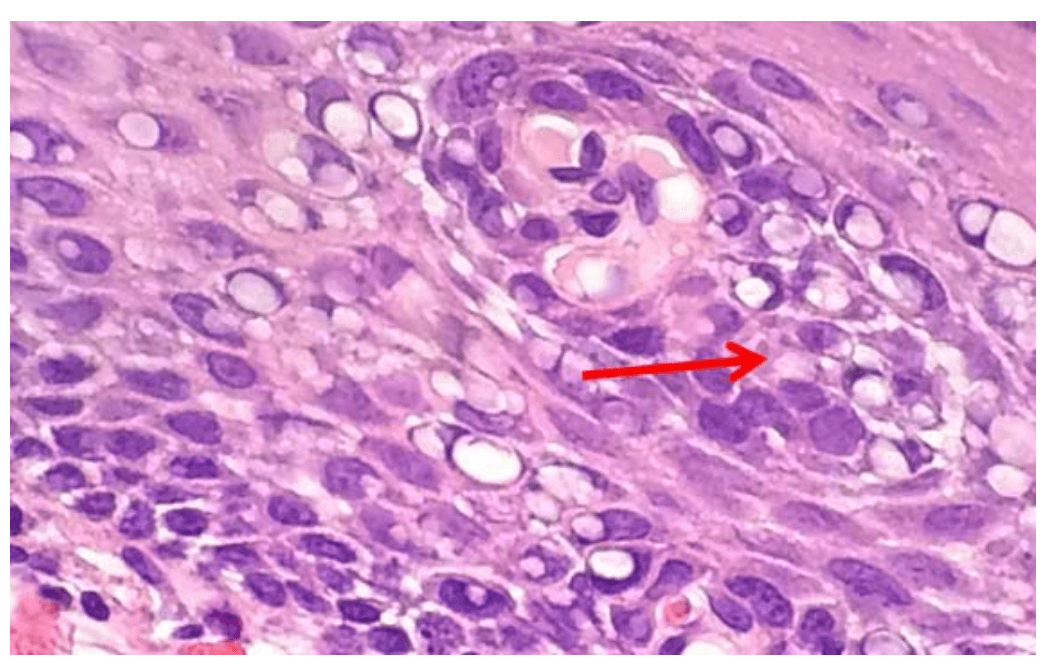 Enzyme Histochemistry
