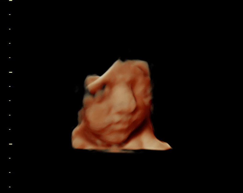 Surgical Double Jeopardy 2022 Chief Edition