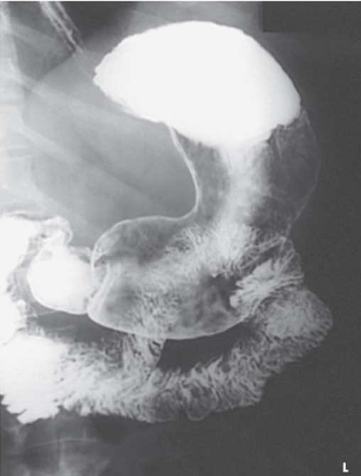 Procedures I Upper Gastrointestinal Tract Jeopardy Template