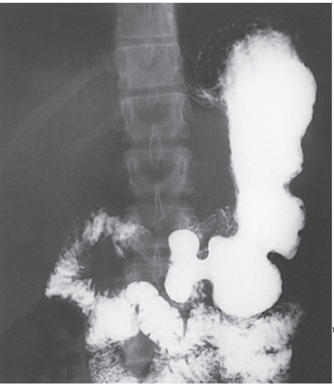 Procedures I Upper Gastrointestinal Tract Jeopardy Template